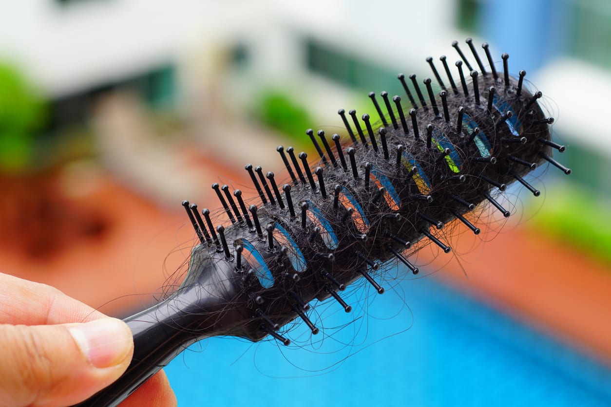 Cara Mengatasi Rambut Rontok Secara Alami