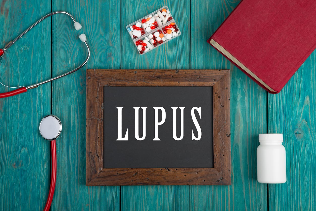 Penyakit Lupus Jenis Tandatanda Penyebab Obat Dll