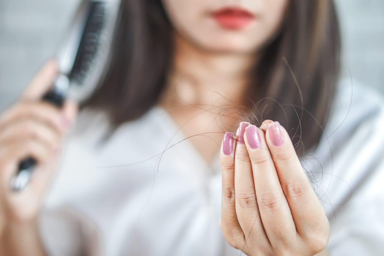 Penyebab Rambut Rontok Parah Yang Harus Diwaspadai Honestdocs