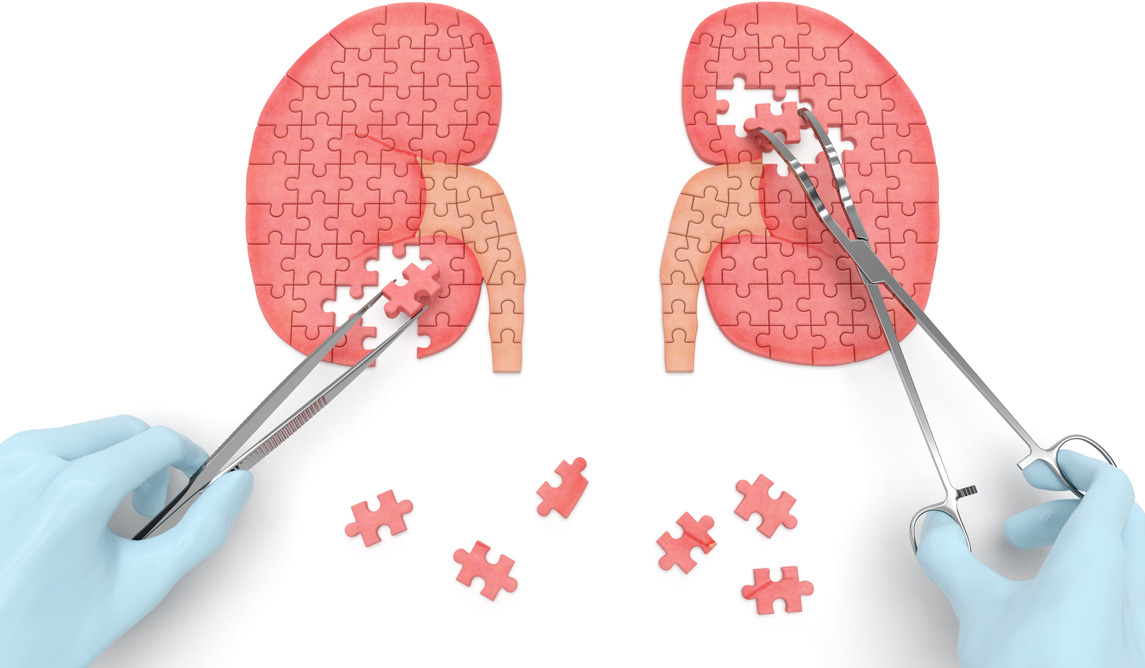 13 Fungsi Ginjal Yang Begitu Penting Bagi Tubuh Honestdocs