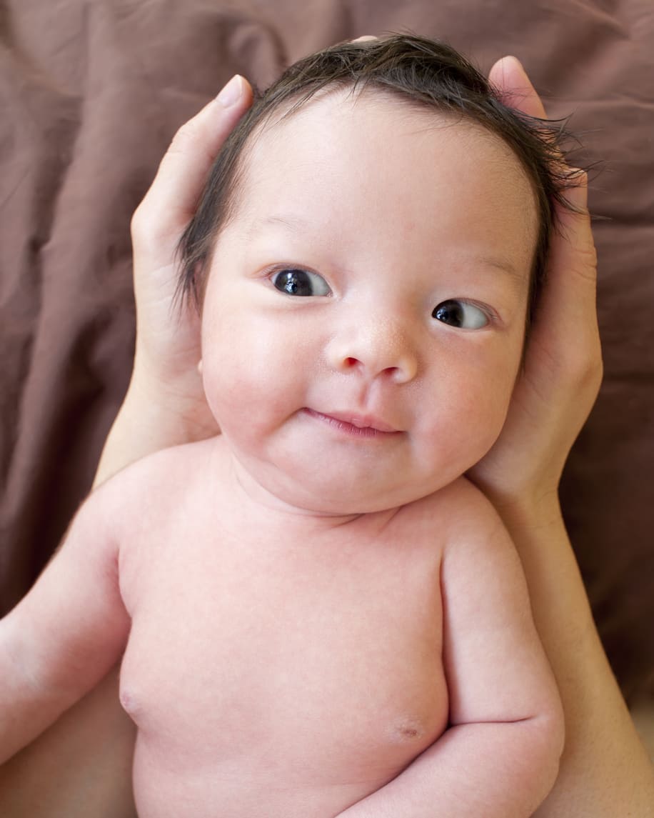 Bintik Putih  pada Bayi  Cara Mengatasinya Milia HonestDocs