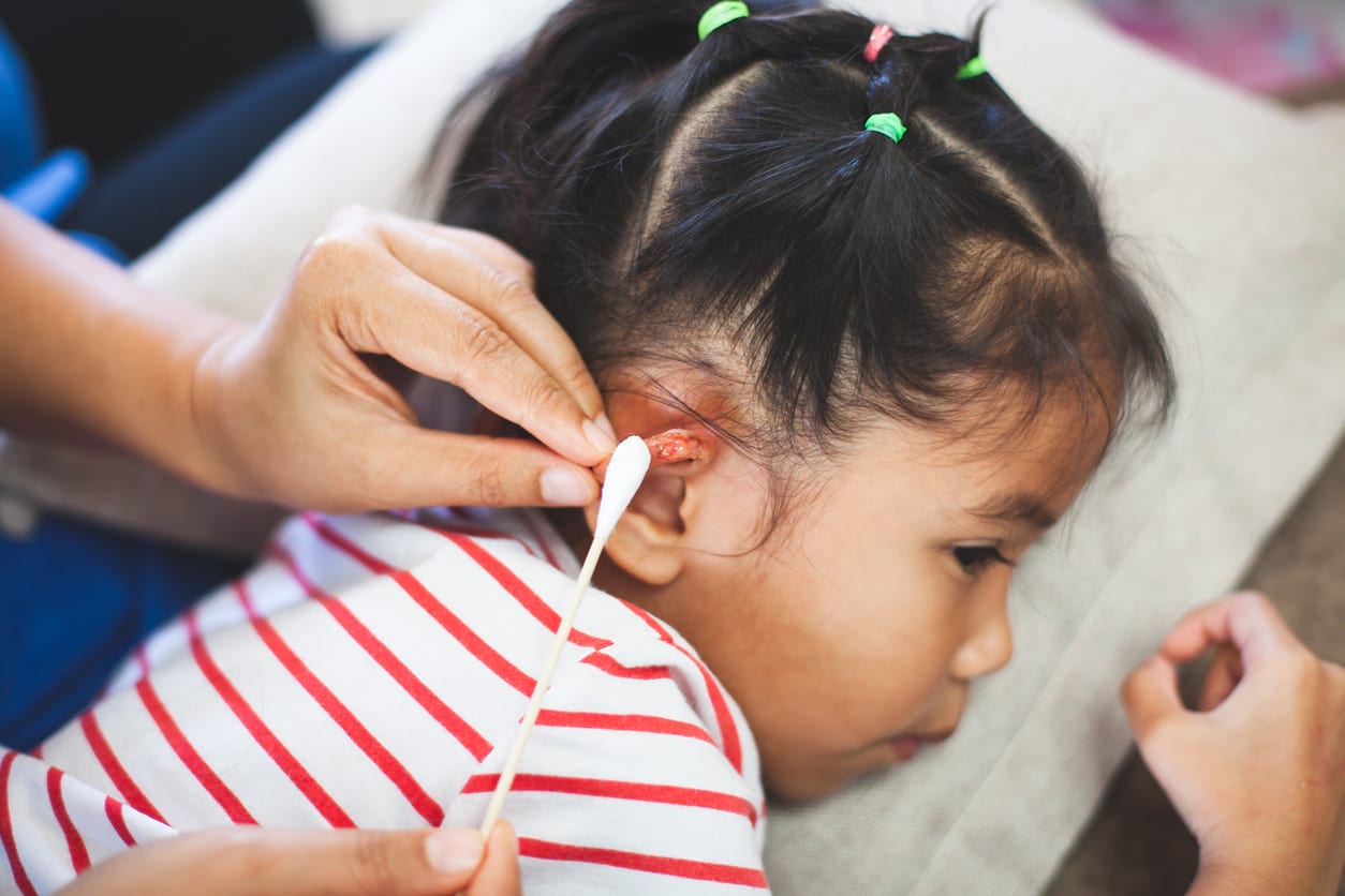  Telinga  Anak Berdarah Apa yang Harus Dilakukan HonestDocs