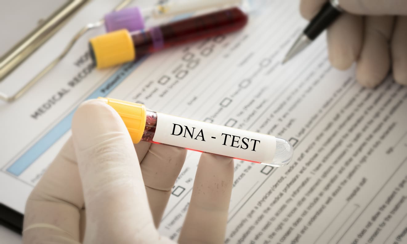 Mengenal Jenis dan Prosedur Tes DNA untuk Mengetahui Garis 