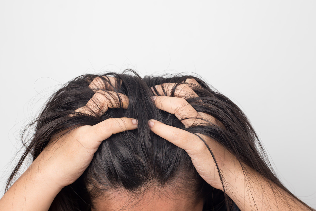 Perbedaan Ketombe dan Dermatitis Seboroik yang Perlu Anda ...