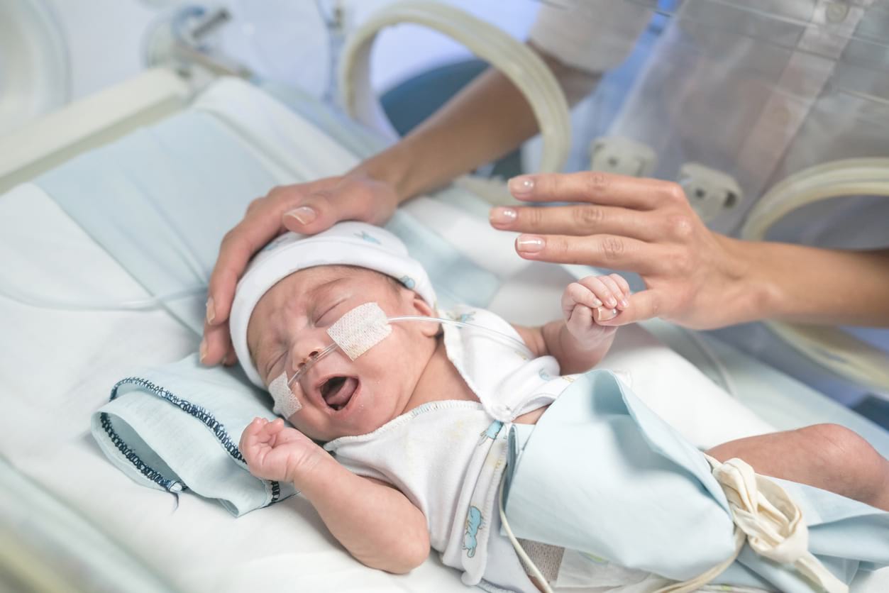  Cacat  Lahir pada Bayi Birth Defects HonestDocs