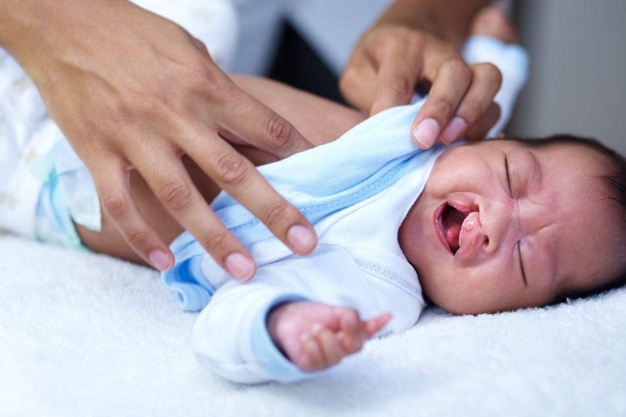 9 Jenis Cacat  Lahir Birth Defects pada Bayi HonestDocs