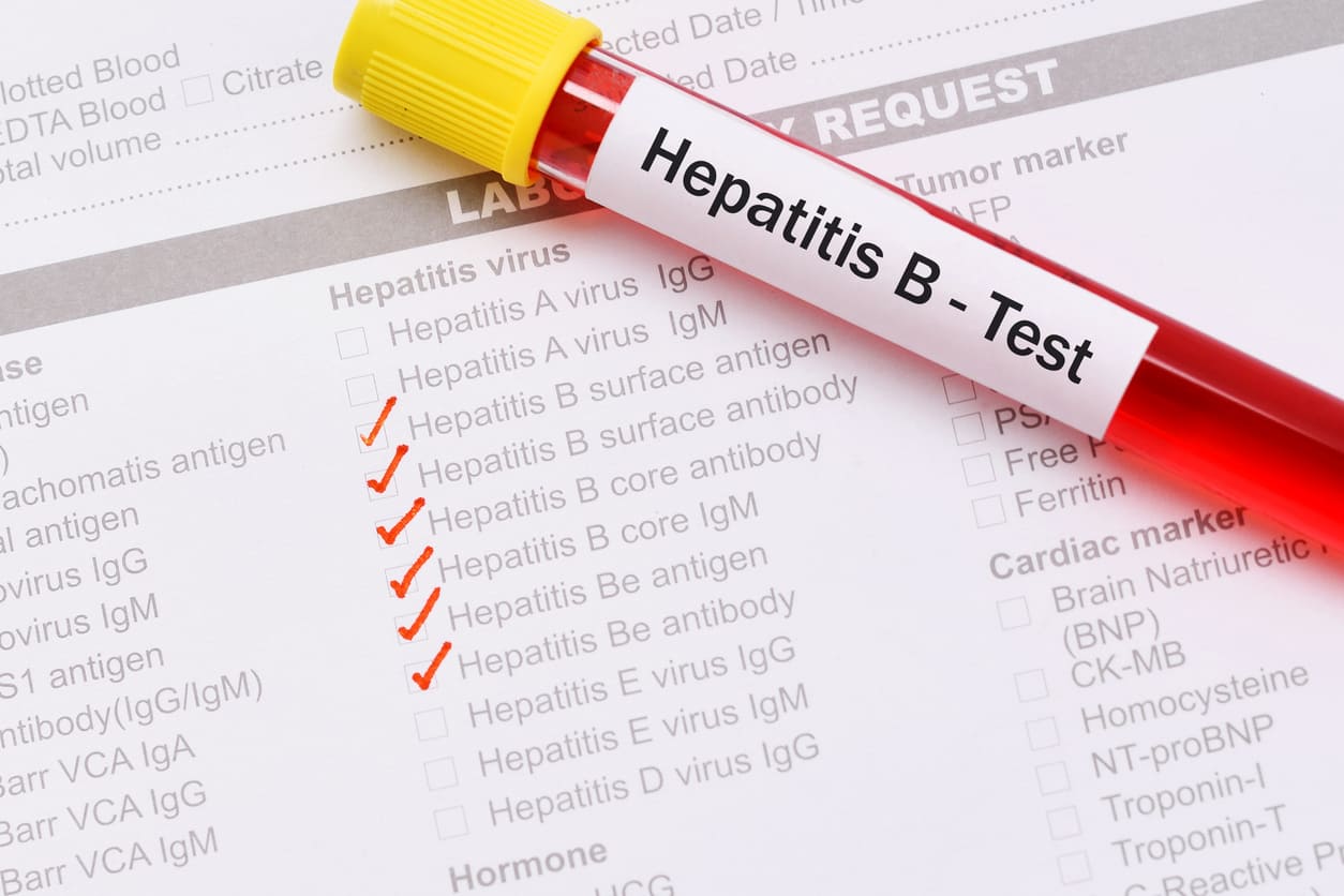 mendiagnosis penyakit hepatitis b