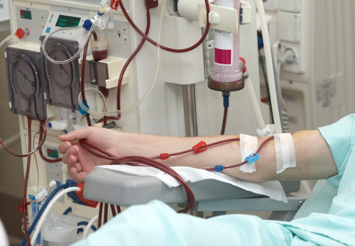 Manfaat Cuci Darah Bagi Penderita Gagal Ginjal | HonestDocs