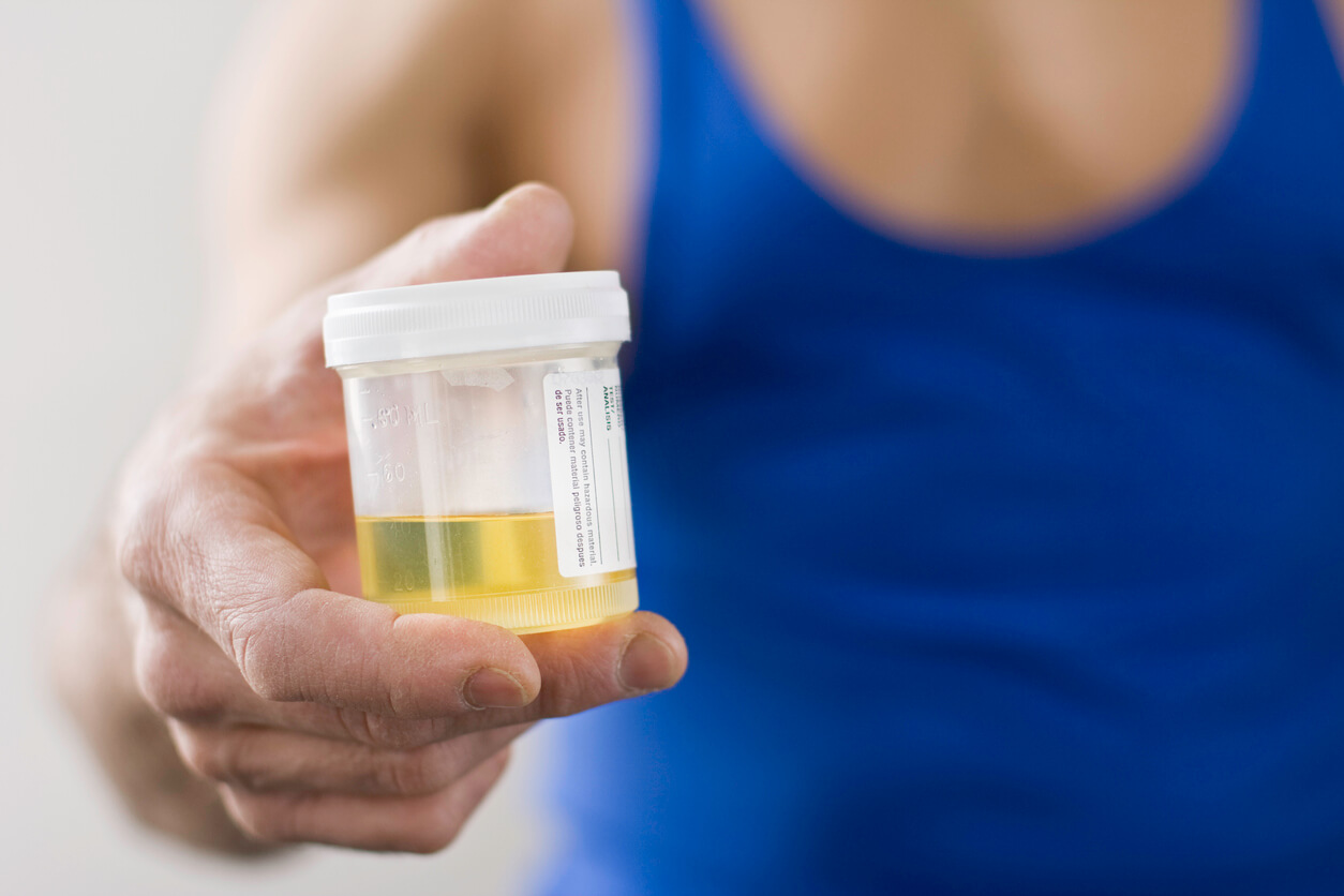 6 Arti Warna Urine HonestDocs