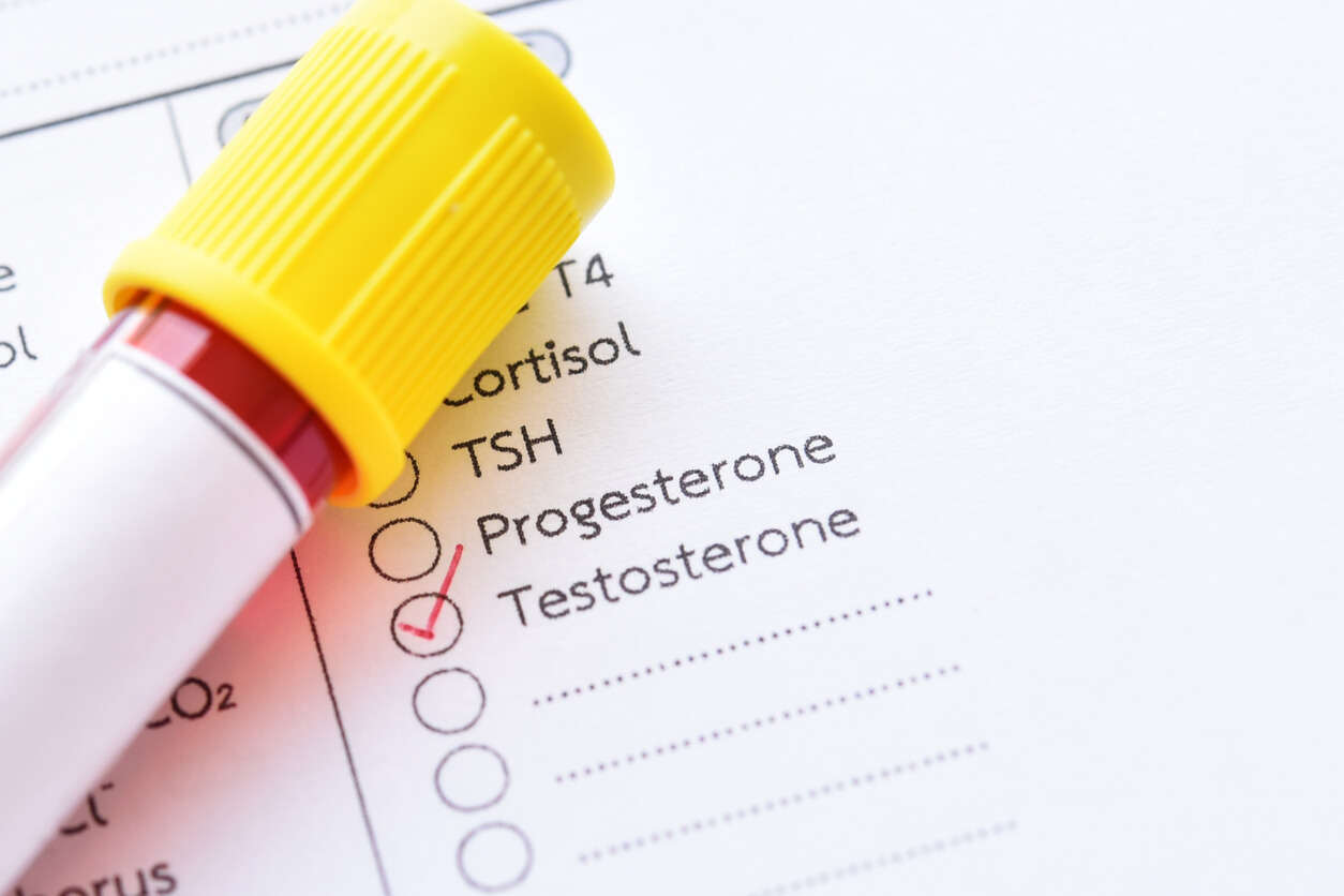 Dampak Bila Tubuh Kelebihan Hormon Testosteron Atau Kekurangan HonestDocs