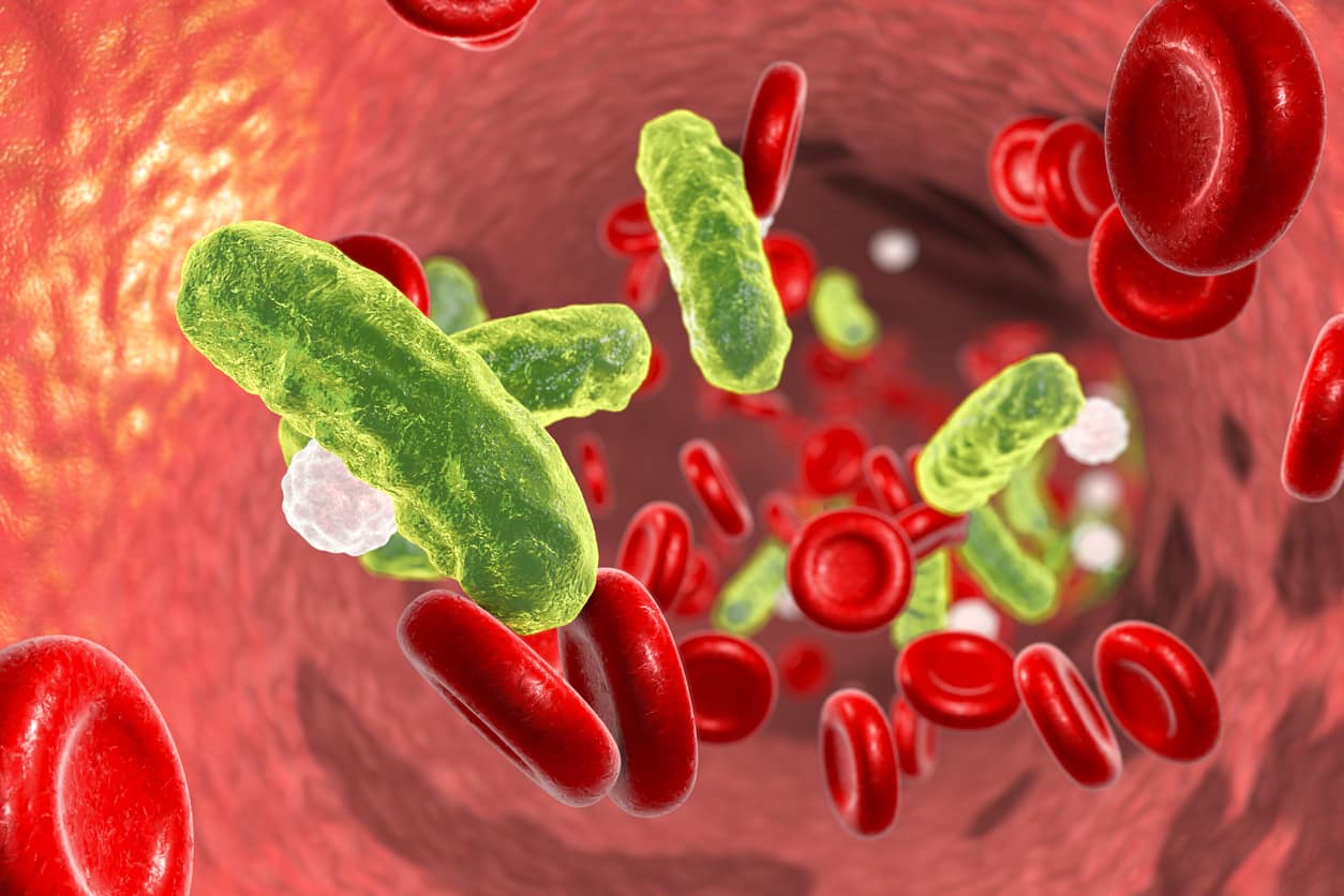 Sepsis Penyebab Gejala Dan Pengobatan Honestdocs
