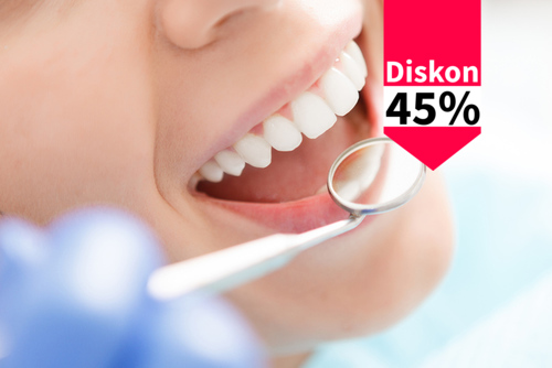 Scaling, Dental Polishing, Fluoride Coating, dan Oral Health Examination di Dentistique clinic