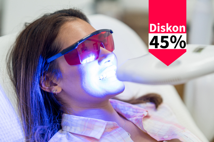 Teeth Bleaching menggunakan LED Light Activator, termasuk Scaling dan Fluoride Coating di Dentistique Clinic