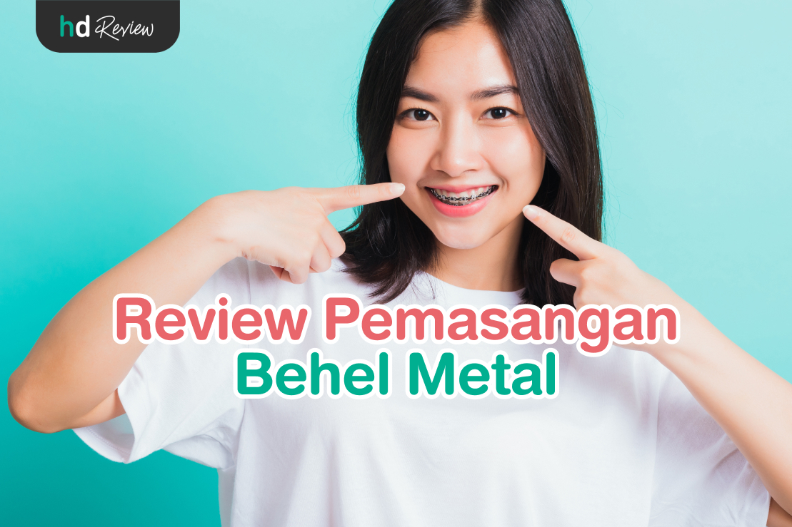 Pemasangan Behel Metal reviews