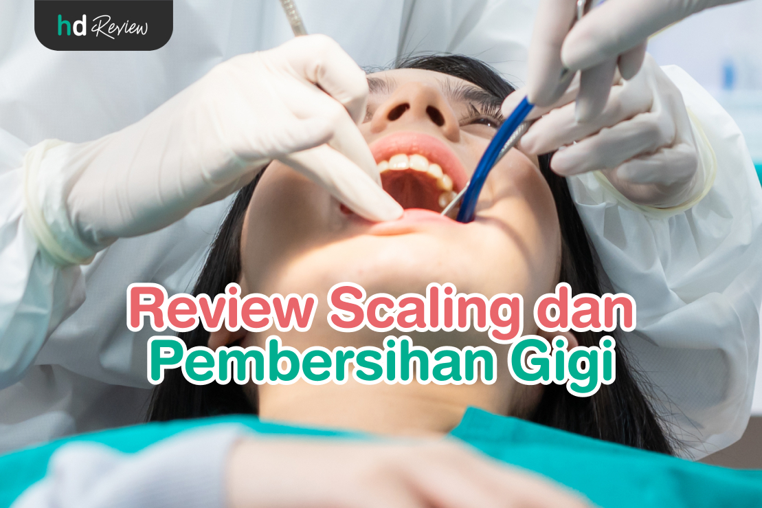 Scaling dan Pembersihan Gigi reviews